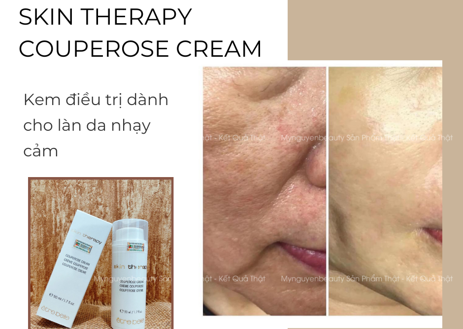 skin therapy couperose cream