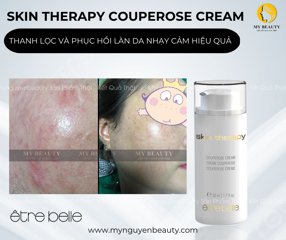 skin therapy couperose cream