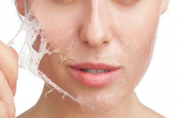 2b bio peeling