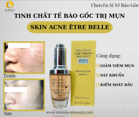 tinh chất skin acne