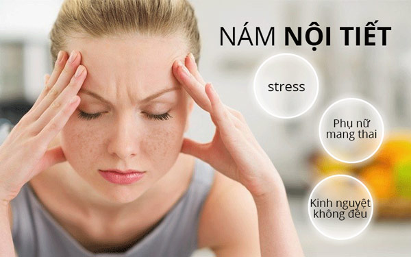 kem lightening protection