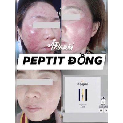 Peptide đồng Dimanlaier